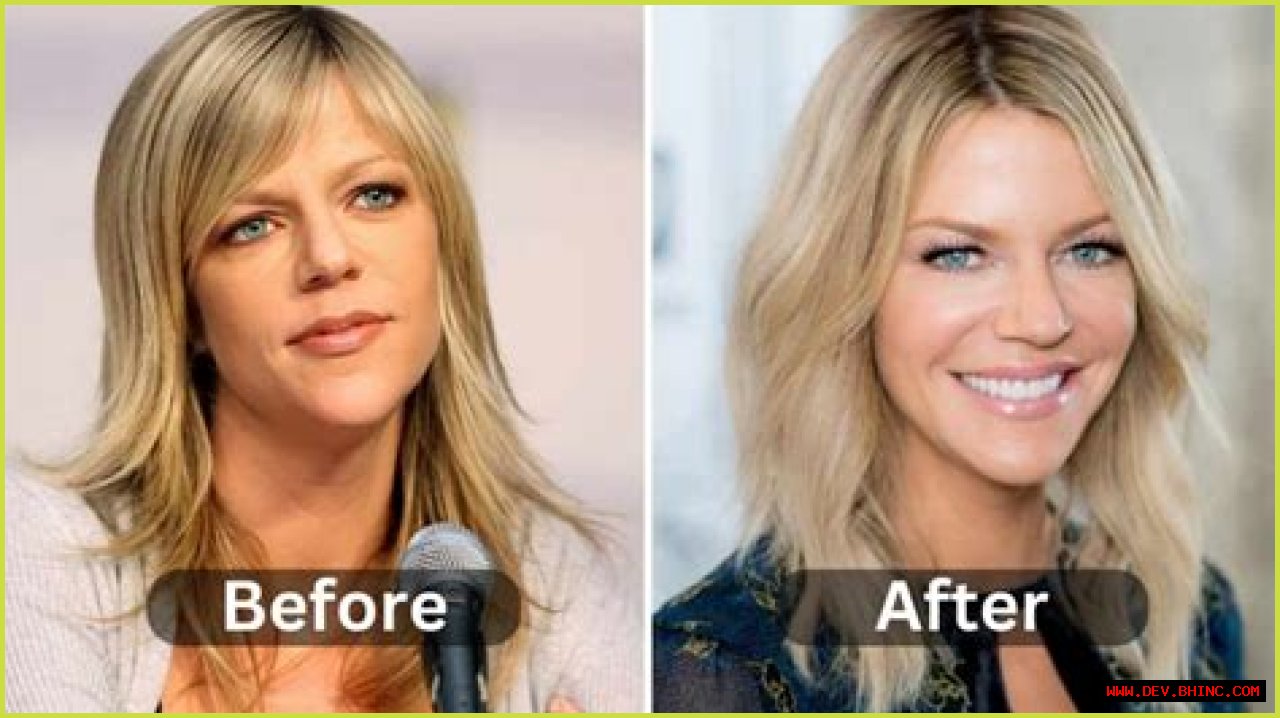 Did Kaitlin Olson Undergo Plastic Surgery? As She Dee From Always Sunny