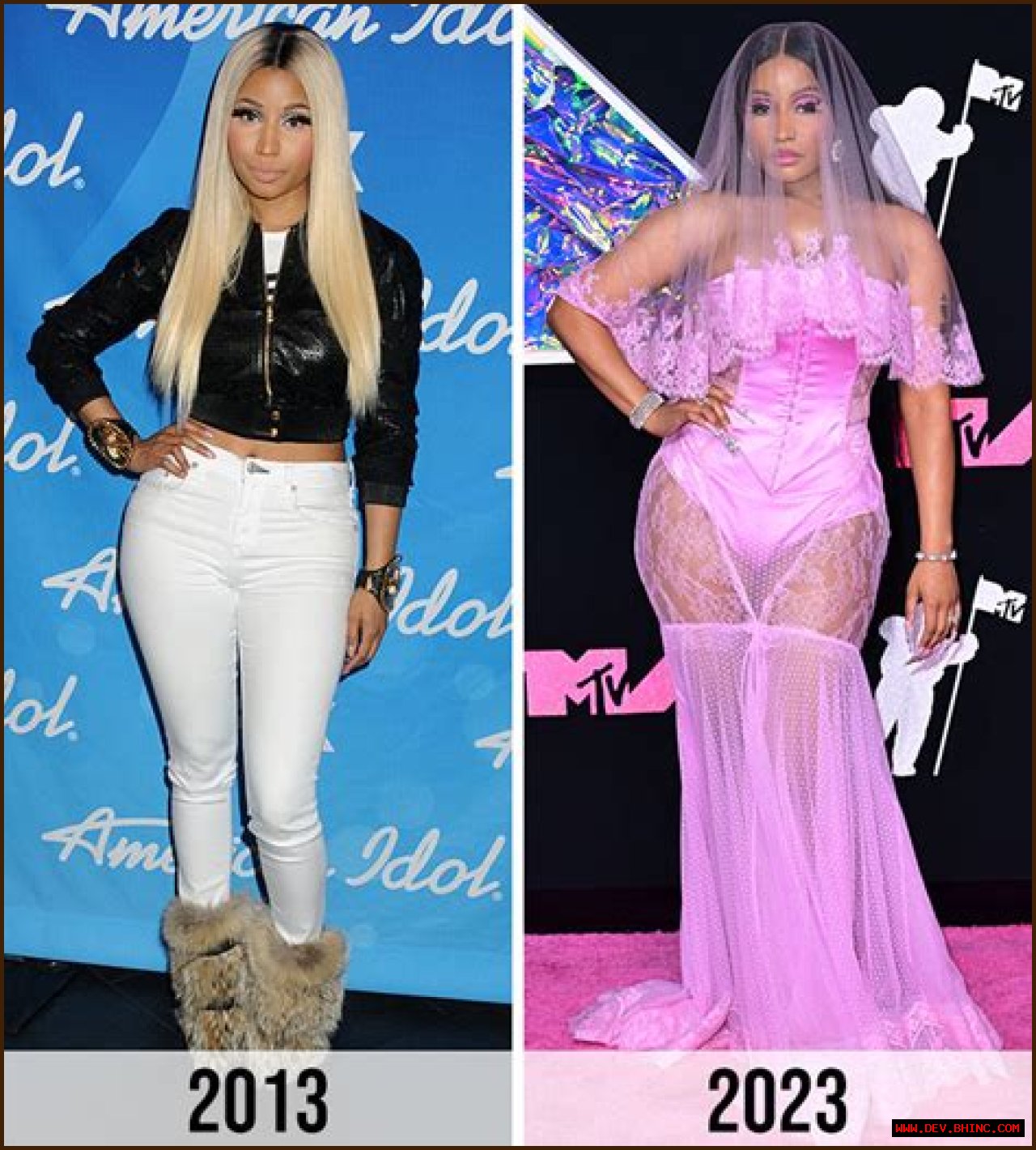 Did Nicki Minaj Ever Get Plastic Surgery? See Photos of Her Transformation Before and After! 
