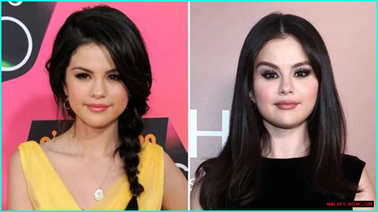 Did Selena Gomez Ever Get Plastic Surgery? Why She Has Sparked Rumors More Than Once