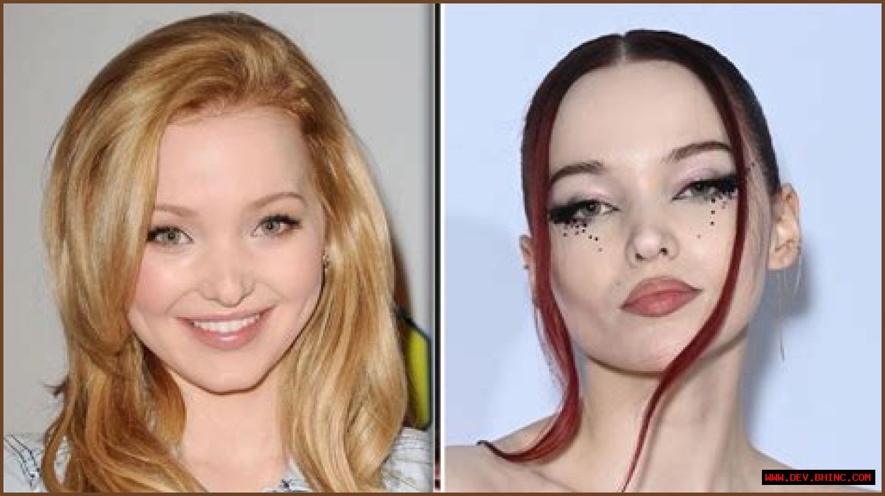 Dove Cameron Has Grown Up in the Public Eye — But Did She Get Plastic Surgery? See Photos