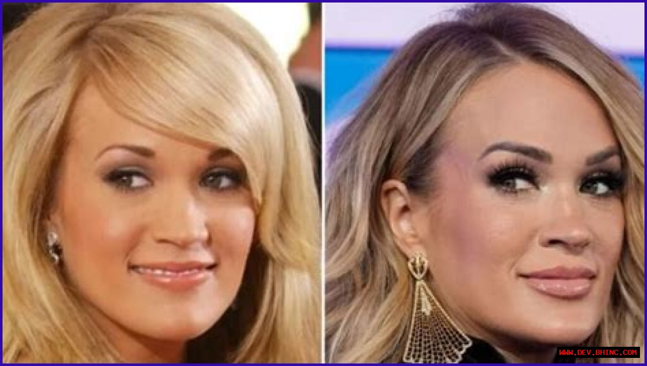 Everything Carrie Underwood Has Said About Plastic Surgery: Photos of the Singer Then and Now