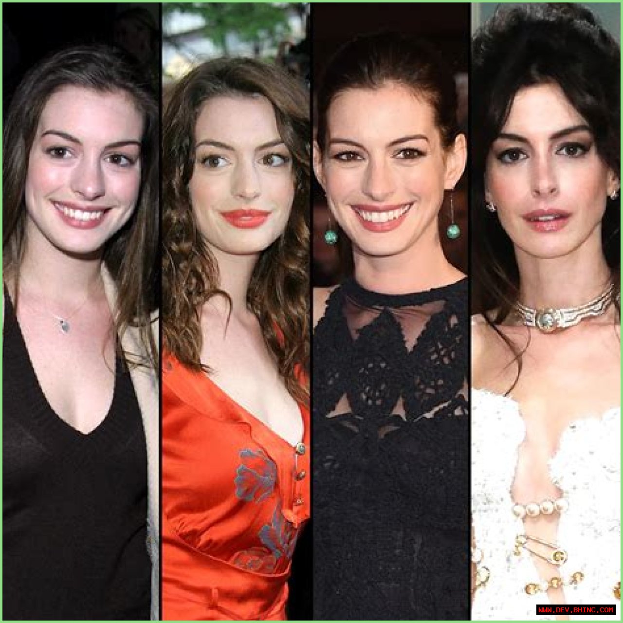 Has Anne Hathaway Undergone Plastic Surgery? See Her Transformation Photos and Quotes