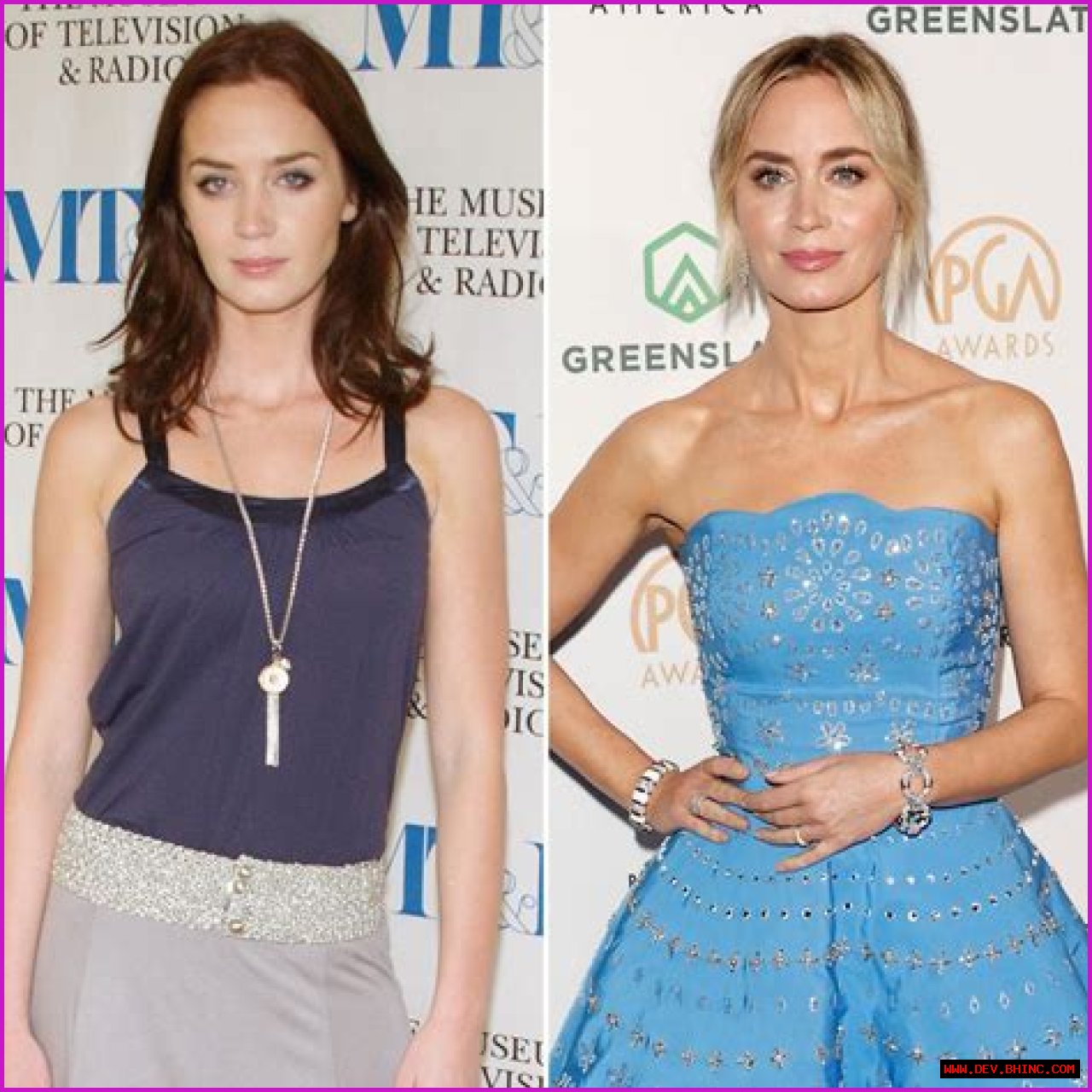 Has Emily Blunt Undergone Plastic Surgery? See the Actress’ Transformation Over the Years