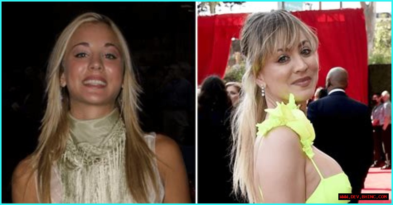 Kaley Cuoco Is Honest About Her Plastic Surgery! See the Actress’ Beautiful Transformation 