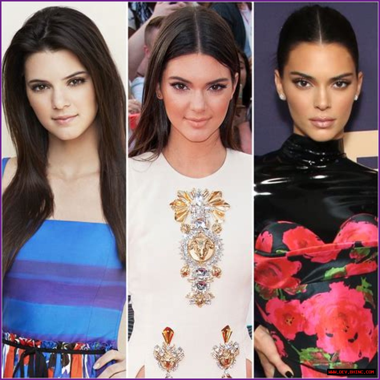 Kendall Jenner Has Long Been the Subject of Plastic Surgery Rumors — But Has She Gone Under the Knife?
