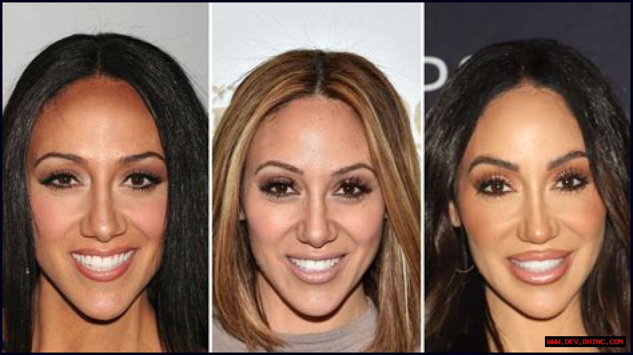 ‘RHONJ’ Star Melissa Gorga Has Undergone Multiple Plastic Surgery Procedures: See Before, After Pics
