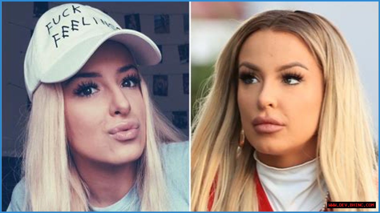 YouTuber Tana Mongeau Has Been Open About Her Plastic Surgery History — Learn What She’s Had Done
